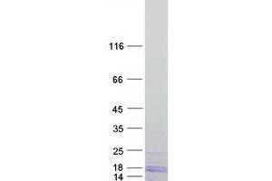 Western Blotting (WB) image for Ribosomal Protein L26 (RPL26) protein (Myc-DYKDDDDK Tag) (ABIN2731134)
