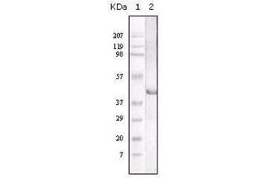 Western blot analysis using LAL mouse mAb against LAL recombinant protein. (Lipase A Antikörper)