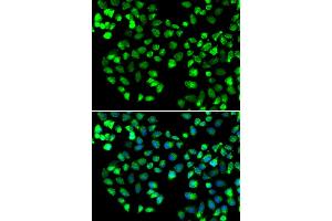 Immunofluorescence analysis of MCF-7 cells using GRM4 antibody (ABIN5974386). (Metabotropic Glutamate Receptor 4 Antikörper)