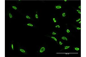 Immunofluorescence of monoclonal antibody to PKN1 on HeLa cell. (PKN1 Antikörper  (AA 462-615))