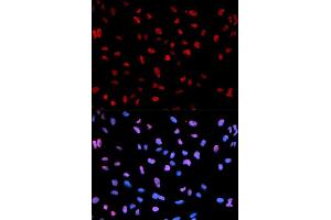 Immunofluorescence analysis of U2OS cells using Phospho-MEF2C-S396 antibody (ABIN5969920). (MEF2C Antikörper  (pSer396))