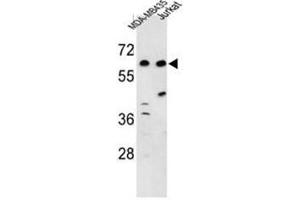 Western blot analysis of C19orf26 Antibody (Center) in MDA-MB435, Jurkat cell line lysates (35µg/lane).