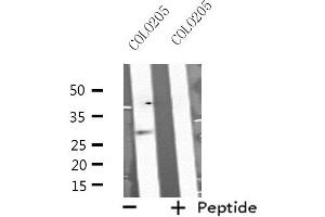 Western blot analysis of extracts from COLO205 cells, using MSX2 antibody. (Msx2/Hox8 Antikörper  (Internal Region))