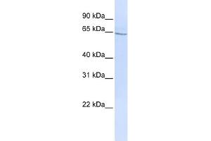 WB Suggested Anti-GLP2R Antibody Titration: 0. (GLP2R Antikörper  (N-Term))