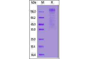 H S1 protein, His Tag on  under reducing (R) condition. (HCoV-NL63 S1 Protein (AA 19-717) protein (His tag))