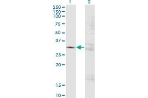 Western Blot analysis of FCN3 expression in transfected 293T cell line by FCN3 monoclonal antibody (M01A), clone 4B4. (FCN3 Antikörper  (AA 1-288))