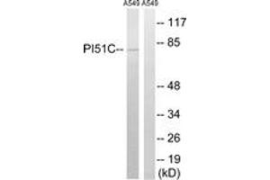 Western blot analysis of extracts from A549 cells, using PIP5K1C Antibody. (PIP5K1C Antikörper  (AA 305-354))