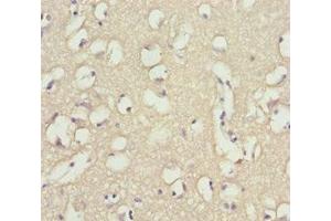 Immunohistochemistry (IHC) image for anti-Inositol Polyphosphate-4-Phosphatase, Type I, 107kDa (INPP4A) (AA 1-250) antibody (ABIN7173958)