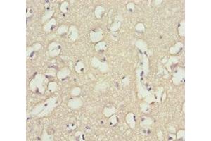 Immunohistochemistry of paraffin-embedded human brain tissue using ABIN7173958 at dilution of 1:100 (INPP4A Antikörper  (AA 1-250))