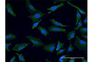 Immunofluorescence of monoclonal antibody to USP9X on HeLa cell. (USP9X Antikörper  (AA 1-90))