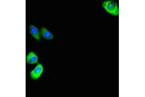 Immunofluorescent analysis of HepG2 cells using ABIN7144175 at dilution of 1:100 and Alexa Fluor 488-congugated AffiniPure Goat Anti-Rabbit IgG(H+L)