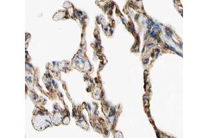 ABIN6266766 at 1/100 staining human lung tissue sections by IHC-P. (TNFAIP8 Antikörper  (Internal Region))