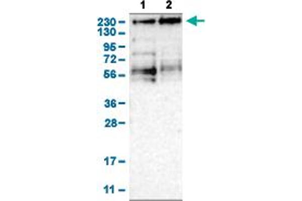 KDM3B Antikörper  (AA 307-448)