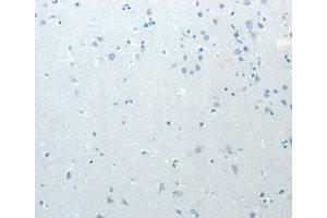 Immunohistochemistry (IHC) image for anti-Minichromosome Maintenance Deficient 4 (MCM4) antibody (ABIN1873665) (MCM4 Antikörper)