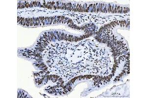 IHC analysis of CPSF6 using anti-CPSF6 antibody (ABIN7601897).