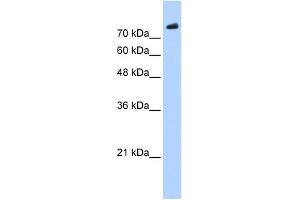 WB Suggested Anti-PHF20 Antibody Titration:  0. (PHF20 Antikörper  (C-Term))
