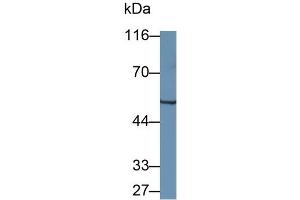 Detection of WARS in Mouse Pancreas lysate using Polyclonal Antibody to Tryptophanyl tRNA Synthetase (WARS) (WARS Antikörper  (AA 29-195))