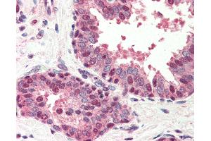 Anti-BIK antibody IHC of human prostate. (BIK Antikörper  (N-Term))