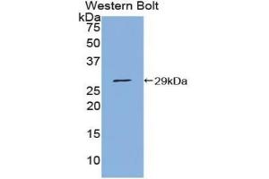 Western blot analysis of the recombinant protein. (PIAS1 Antikörper  (AA 409-645))