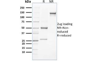 SDS-PAGE Analysis Purified CLEC9A Mouse Monoclonal Antibody (8F9). (CLEC9A Antikörper)