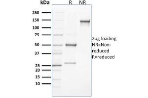 SDS-PAGE (SDS) image for anti-C-Type Lectin Domain Family 9, Member A (CLEC9A) antibody (ABIN6939549)