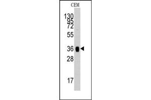 Image no. 1 for anti-Aldolase A, Fructose-Bisphosphate (ALDOA) (N-Term) antibody (ABIN357866) (ALDOA Antikörper  (N-Term))