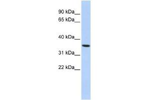 WB Suggested Anti-PAQR6 Antibody Titration:  0. (PAQR6 Antikörper  (N-Term))