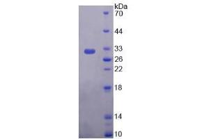 Image no. 1 for Plectin (PLEC) (AA 175-400) protein (His tag) (ABIN6236909) (PLEC Protein (AA 175-400) (His tag))