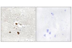 Immunohistochemistry (IHC) image for anti-Zinc Finger Protein 287 (ZNF287) (Internal Region) antibody (ABIN1849990) (ZNF287 Antikörper  (Internal Region))