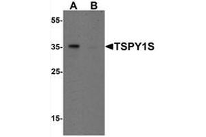 Western blot analysis of TSPY1S in A20 cell lysate with TSPY1S Antibody  at 1 μg/mL in (A) the absence and (B) the presence of blocking peptide (TSPY1 Antikörper  (C-Term, Isoform 1))