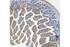 anti-Loricrin (LOR) (AA 1-312) antibody