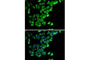 Immunofluorescence analysis of A-549 cells using PTGES2 antibody (ABIN6129085, ABIN6146404, ABIN6146406 and ABIN6222952). (PTGES2 Antikörper  (AA 88-377))