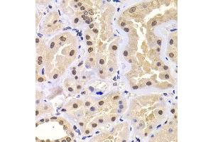 Immunohistochemistry of paraffin-embedded human kidney using PRDM14 antibody at dilution of 1:100 (x400 lens). (PRDM14 Antikörper)