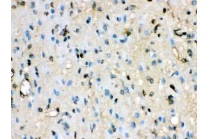Immunohistochemistry (IHC) image for anti-Valosin Containing Protein (VCP) (AA 732-760), (C-Term) antibody (ABIN3043958)