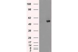 Image no. 2 for anti-V-Akt Murine Thymoma Viral Oncogene Homolog 2 (AKT2) antibody (ABIN1496565) (AKT2 Antikörper)