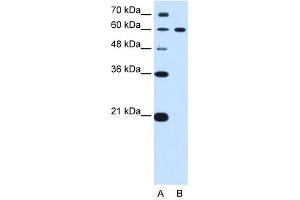 DTX2 antibody used at 0. (DTX2 Antikörper)