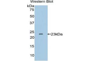 Western blot analysis of the recombinant protein. (VEGFB Antikörper  (AA 22-207))