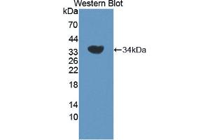 Western blot analysis of the recombinant protein. (ADRBK2 Antikörper  (AA 191-453))