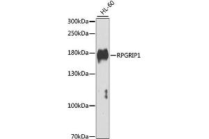 Western blot analysis of extracts of HL-60 cells, using RPGRIP1 antibody (ABIN4905033) at 1:1000 dilution.