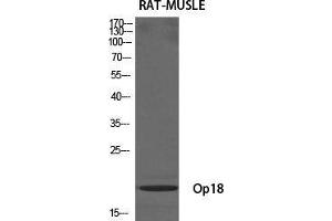 Western Blot (WB) analysis of specific cells using Op18 Polyclonal Antibody. (Stathmin 1 Antikörper  (Ser729))
