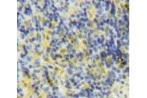 Used in DAB staining on fromalin fixed paraffin-embedded Spleen tissue (XCL1 Antikörper  (AA 26-111))