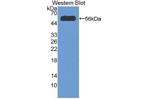 Detection of Recombinant CRN, Human using Polyclonal Antibody to Corin (CRN)