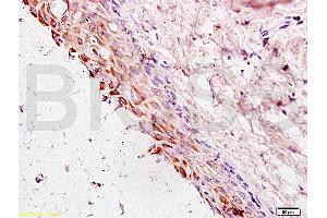 Formalin-fixed and paraffin embedded rat ovary tissue labeled with Anti-Cyclin G Polyclonal Antibody, Unconjugated (ABIN685837) at 1:200 followed by conjugation to the secondary antibody and DAB staining (Cyclin G1 Antikörper  (AA 181-295))