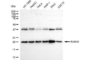 Western blotting analysis using RAB10 antibody (ABIN7800087). (Rekombinanter RAB10 Antikörper)