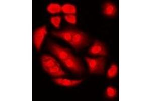 Immunofluorescent analysis of Int11 staining in Hela cells. (CPSF3L Antikörper)