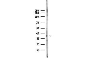 anti-Proteasome (Prosome, Macropain) 26S Subunit, Non-ATPase, 7 (PSMD7) (C-Term) antibody