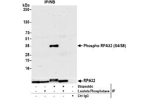 Immunoprecipitation (IP) image for anti-Replication Protein A2, 32kDa (RPA2) (pSer4), (pSer8) antibody (ABIN7455212) (RPA2 Antikörper  (pSer4, pSer8))