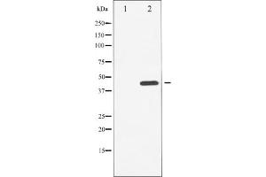Western blot analysis of Chk1 phosphorylation expression in UV treated HuvEc whole cell lysates,The lane on the left is treated with the antigen-specific peptide. (CHEK1 Antikörper  (pSer296))