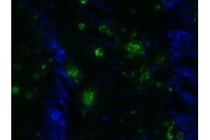 Indirect immunostaining of a PFA fixed brain section from a 5XFAD mouse (dilution 1 : 500; green). (Abeta 1-40 Antikörper)