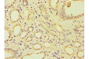 Immunohistochemistry of paraffin-embedded human kidney tissue using ABIN7144692 at dilution of 1:100 (ARSF Antikörper  (AA 1-200))